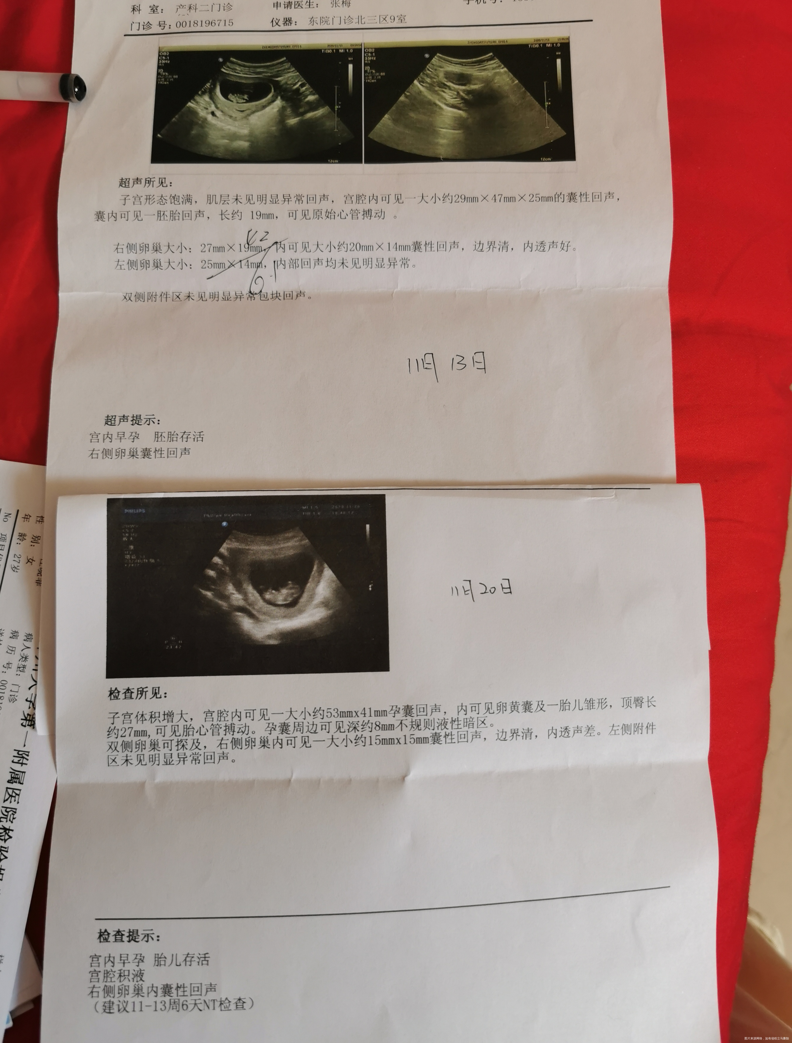 医生你好刚怀孕时四十多天第一次做b超查出有宫