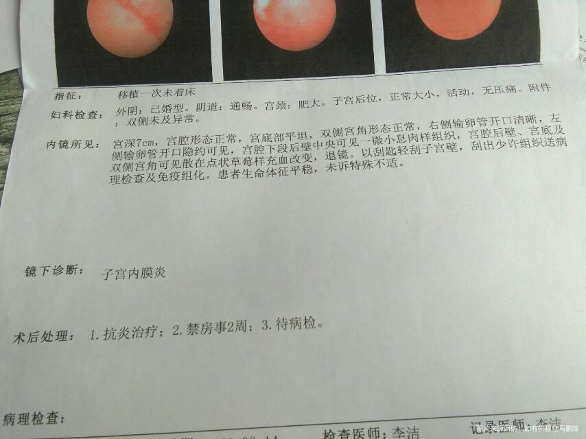 做宫腔镜检查结果然后吃消炎药