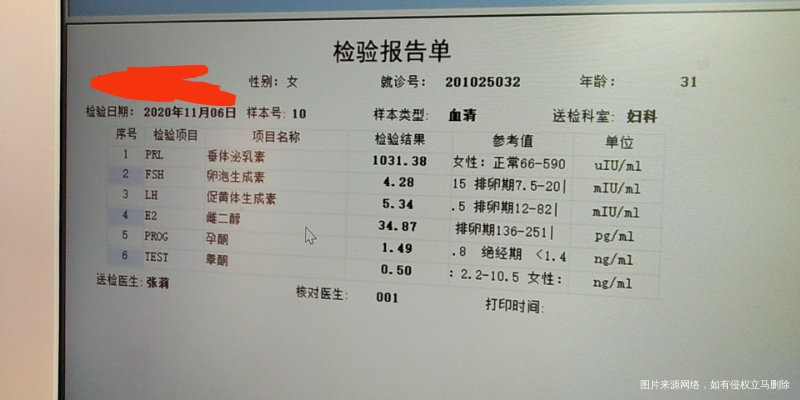 不知道我这个是不是多囊咨询医生