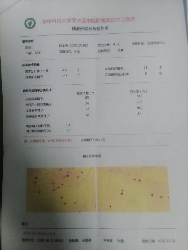 检查结果严重吗结婚2年了