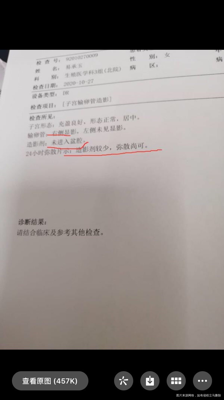 一年前做过宫腹腔镜手术这次