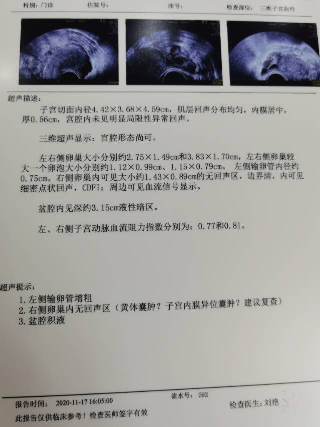 备孕三年未孕之前我也没有怀孕过四月份查的卵巢