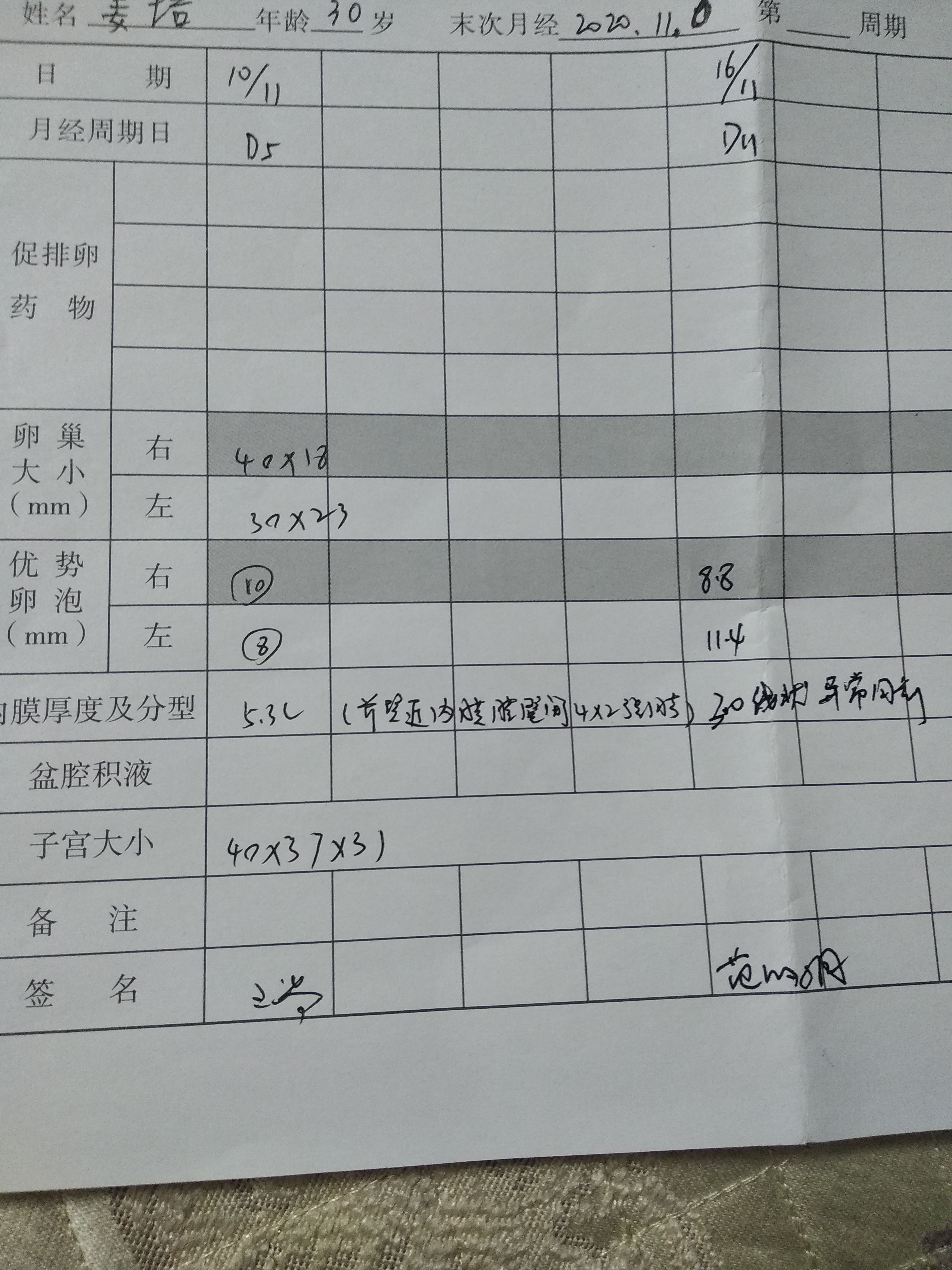 第三次促排了前两次都是左侧排卵未怀孕这次说内