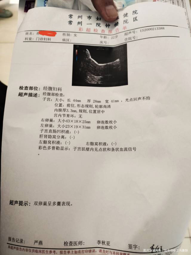 我10月查出来多囊体重173斤身高169这个