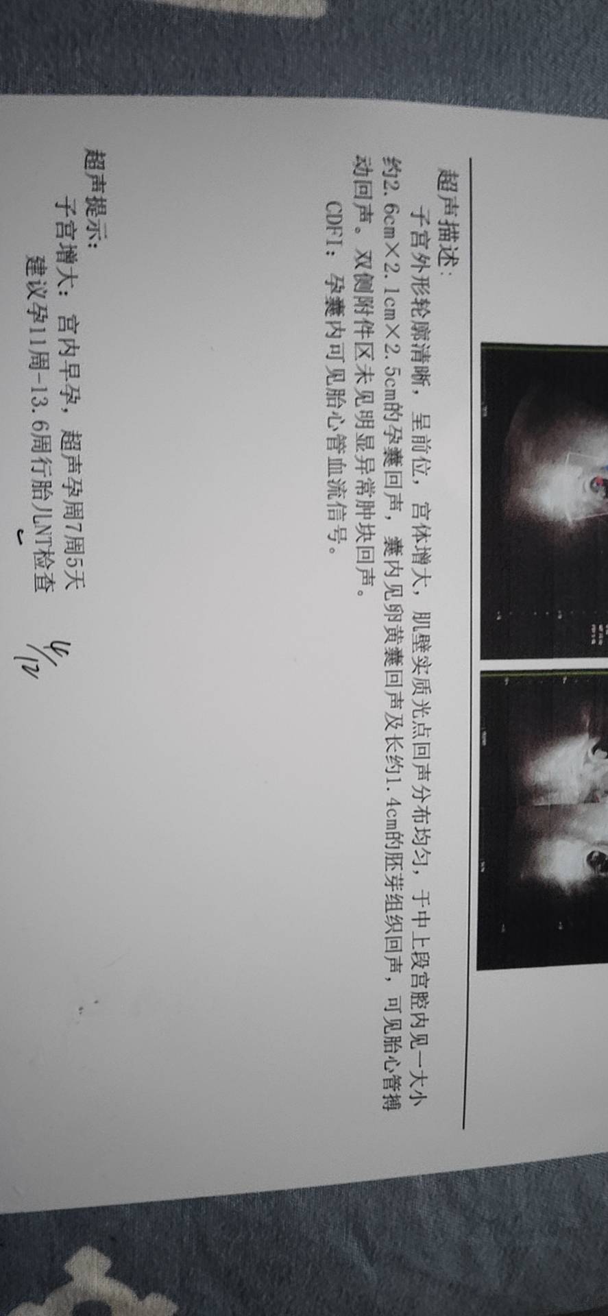 末次94发育偏小正常吗孕囊一直偏小促排怀孕的