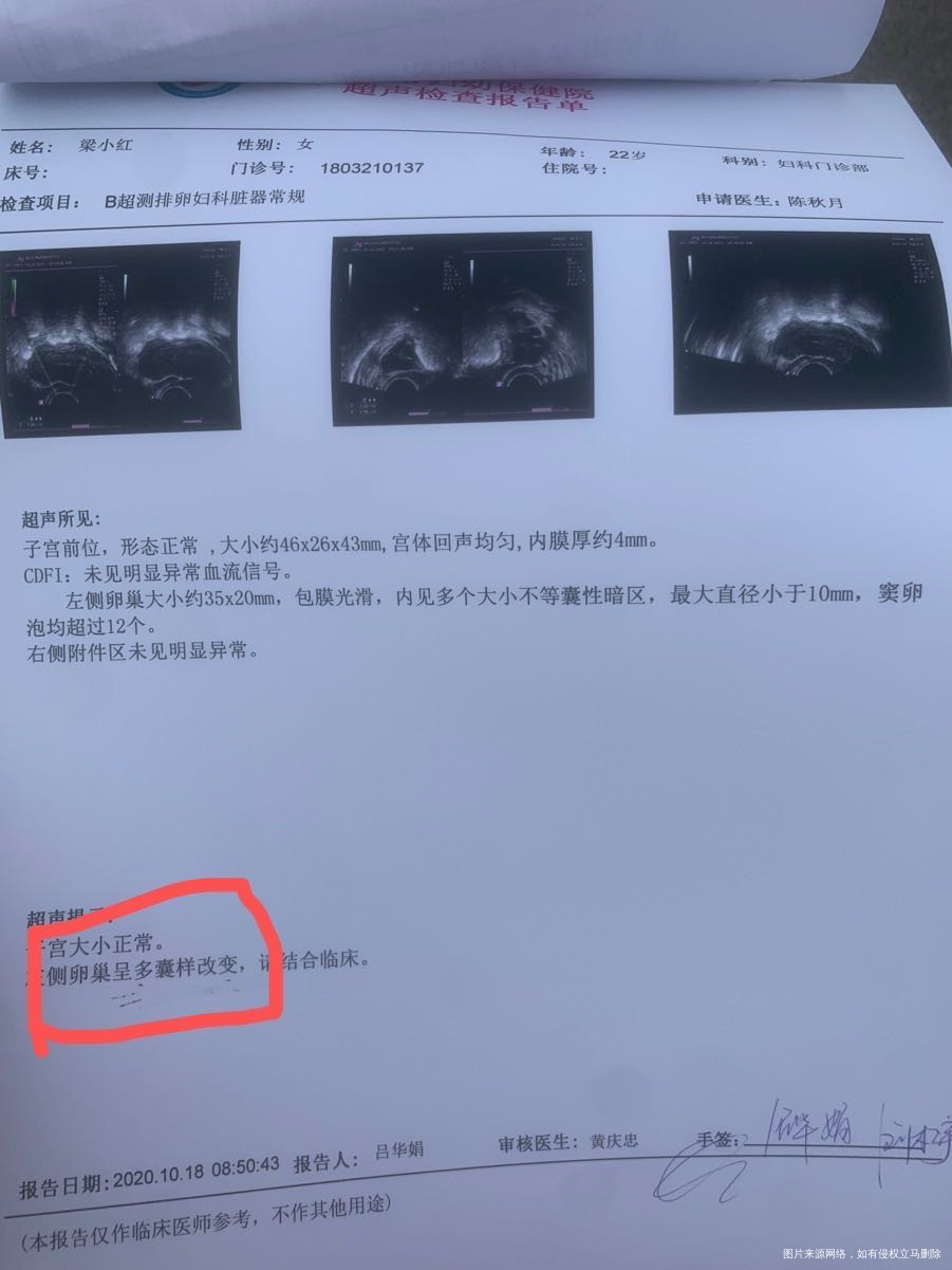 月经推迟2天早早孕试纸测试白板月经又不来医生