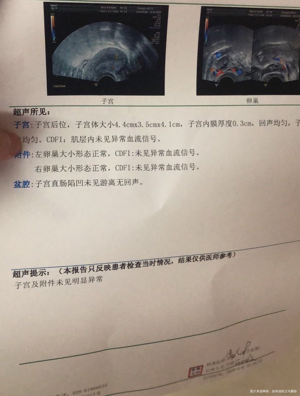 医生您好我于2020年4月做孕前检查发现左侧