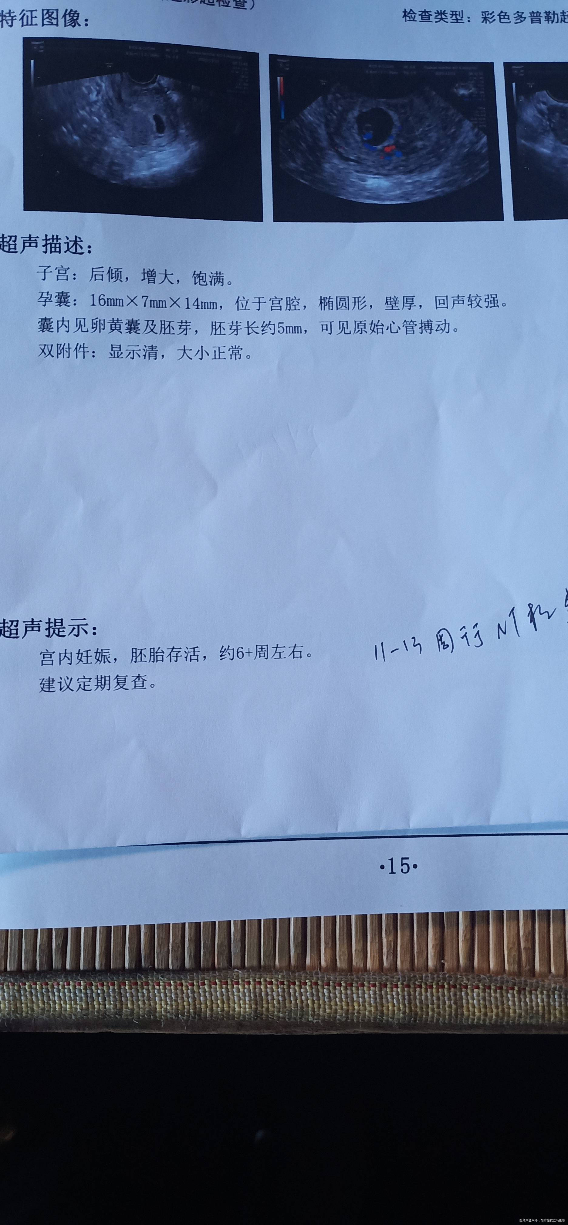 日期hcg5号14687号386210号15