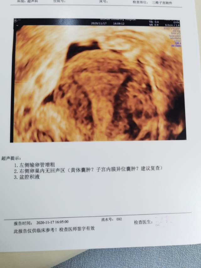 备孕三年未孕之前我也没有怀孕过四月份查的卵巢