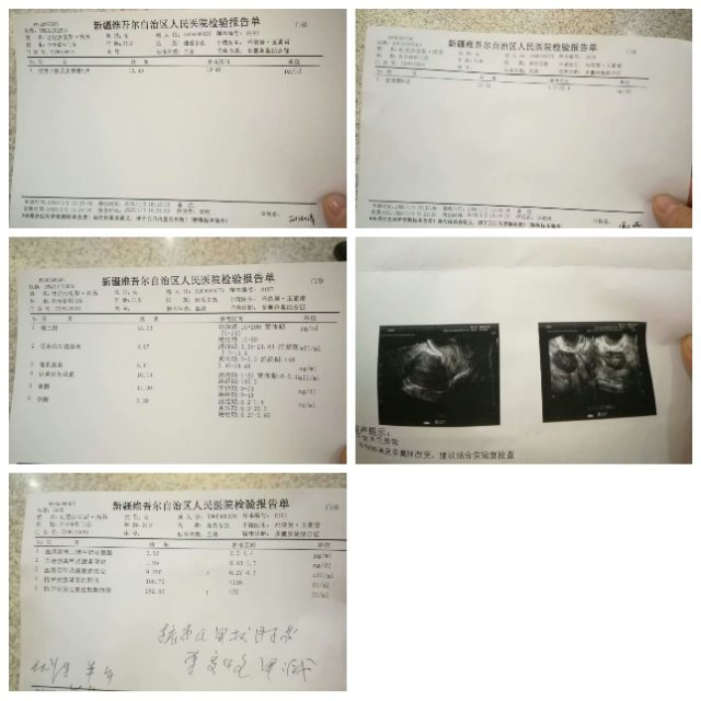 那个医生给我看看这个化验单说一下诊断一下我现