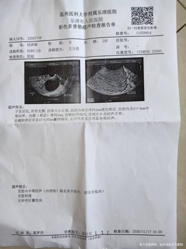 医生你好我是10月13号药流排出孕囊的然后两