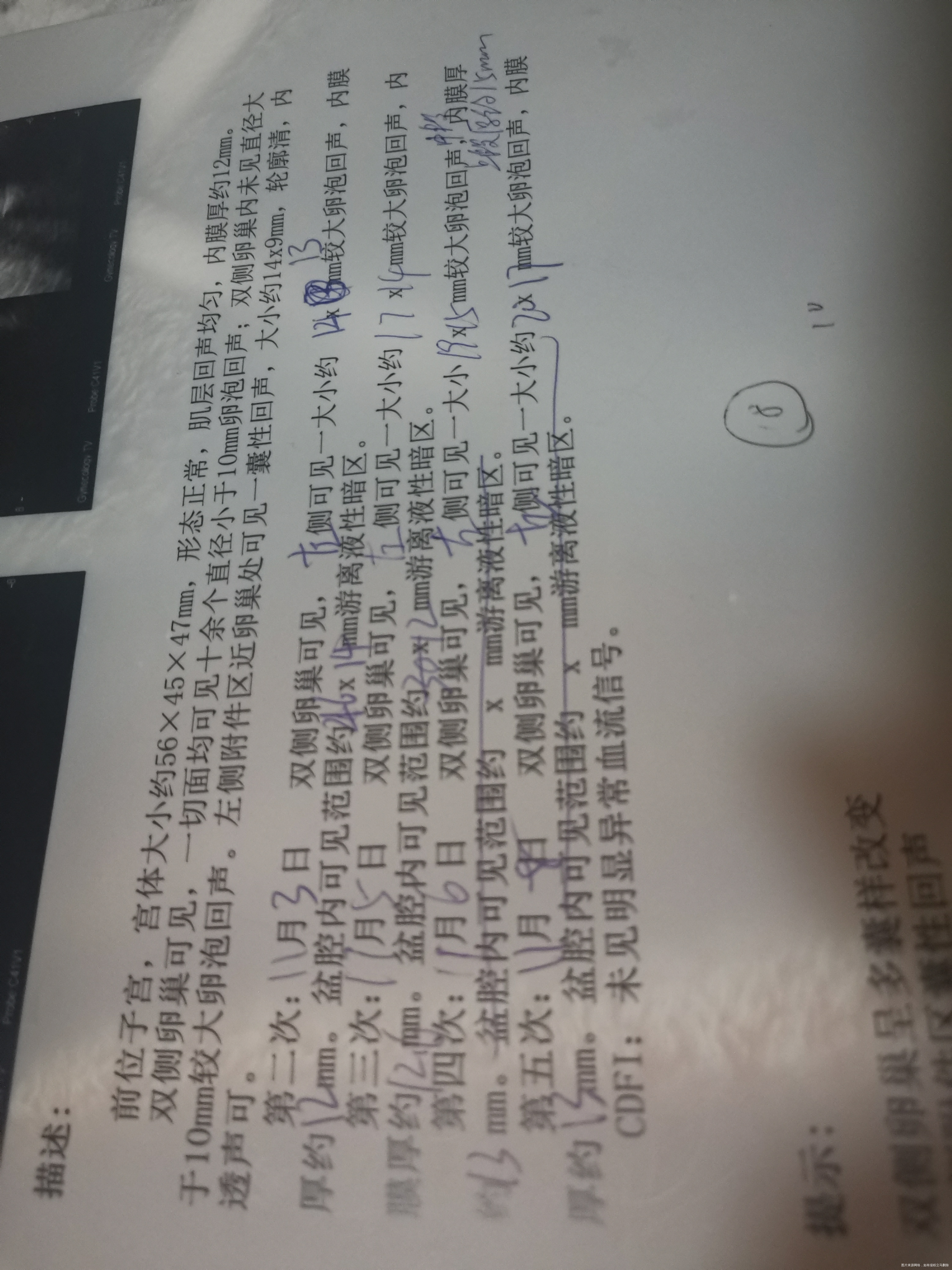 卵泡是2219但是卵泡不破打了破卵针也没破内