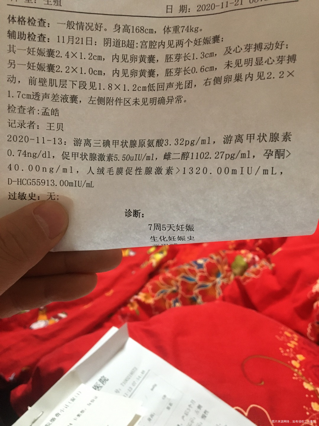 7周5天一妊娠22×10内见卵黄囊胚芽长06