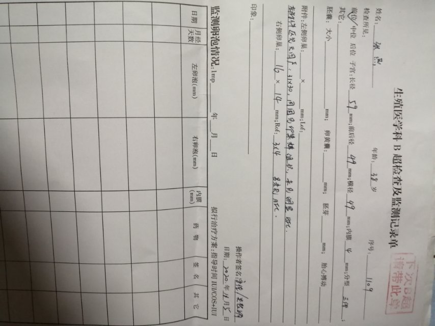 一月份取环三个月后备孕但是老公经常出差排卵期