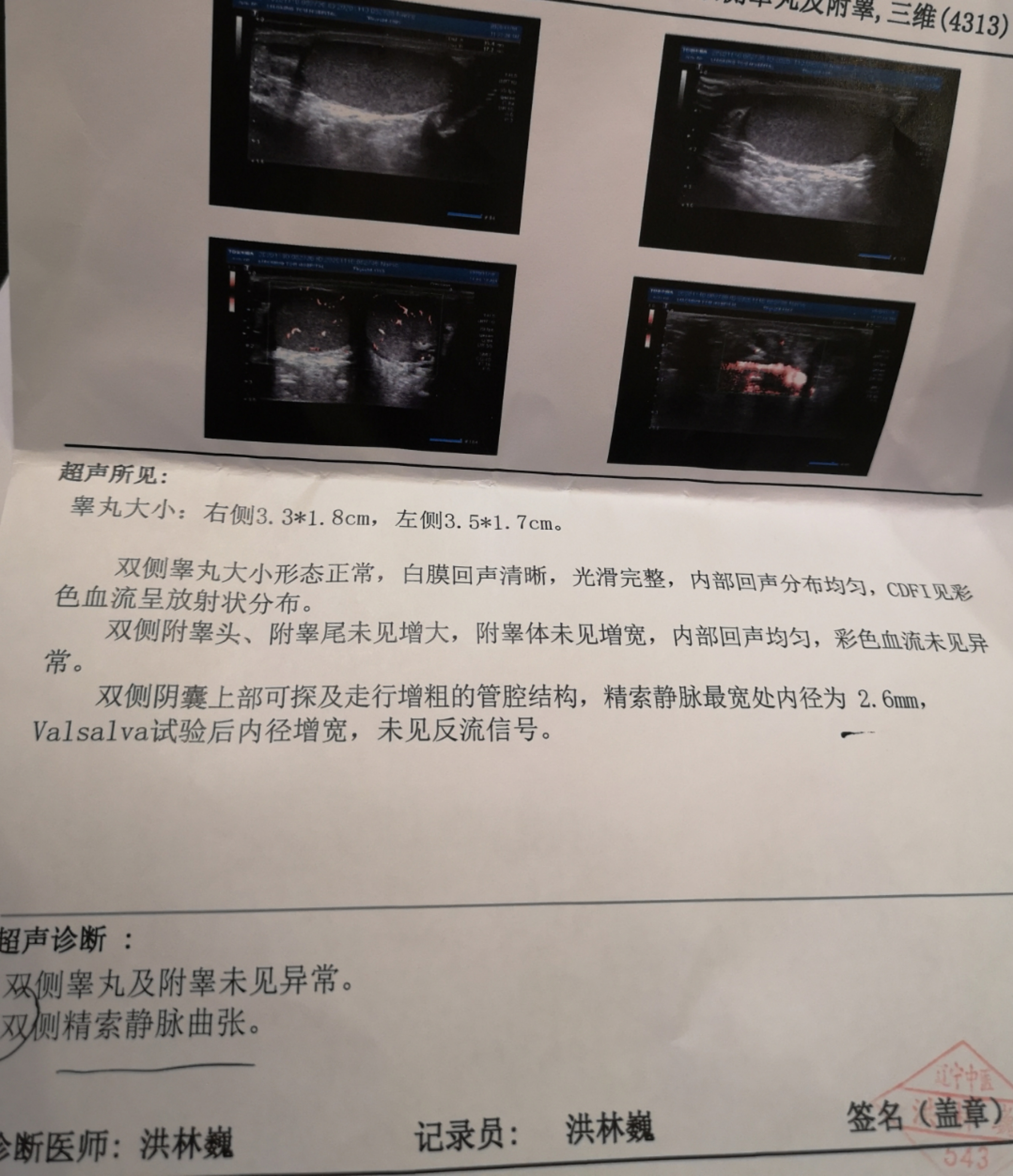 精子质量不好活力低需要手术吗