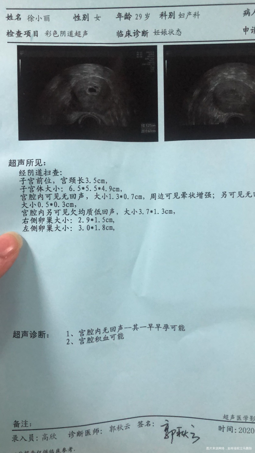 1026移植囊胚一枚移植19天出血就医b超显