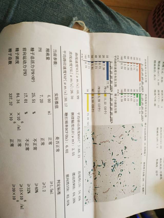 我多囊我老公精子不液化活力弱之前我做过促排卵