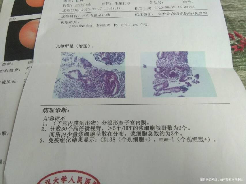 做宫腔镜检查结果然后吃消炎药