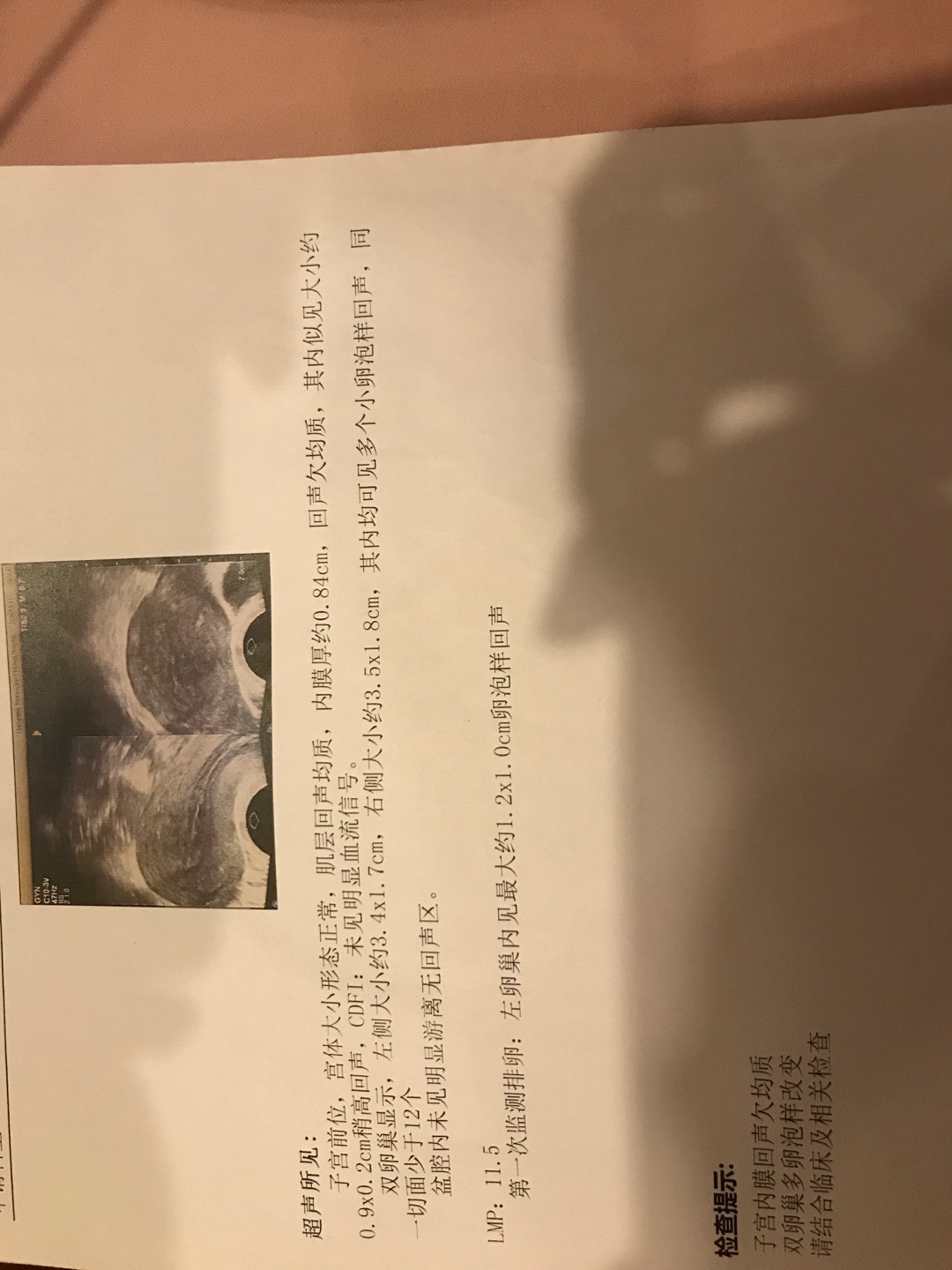 结婚56年一直没有怀上过月经周期3540经期