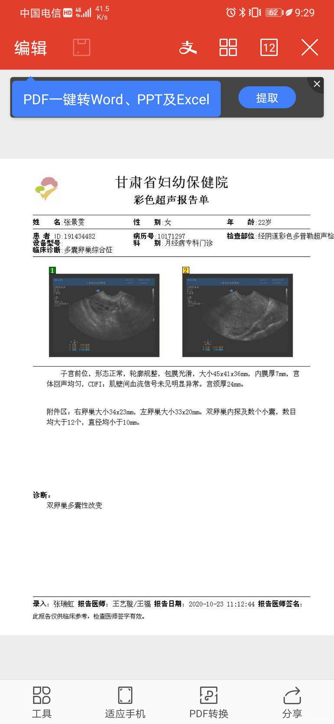 多囊卵巢综合症目前月经每个月可以自己来但是会