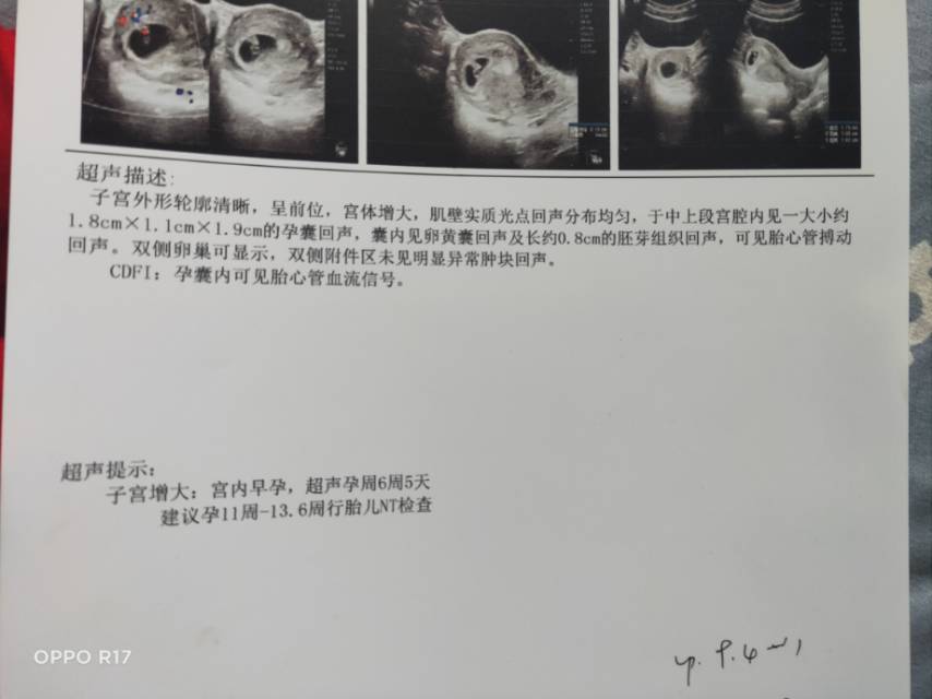 末次94发育偏小正常吗孕囊一直偏小促排怀孕的