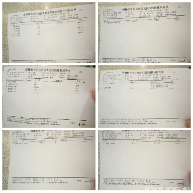 那个医生给我看看这个化验单说一下诊断一下我现