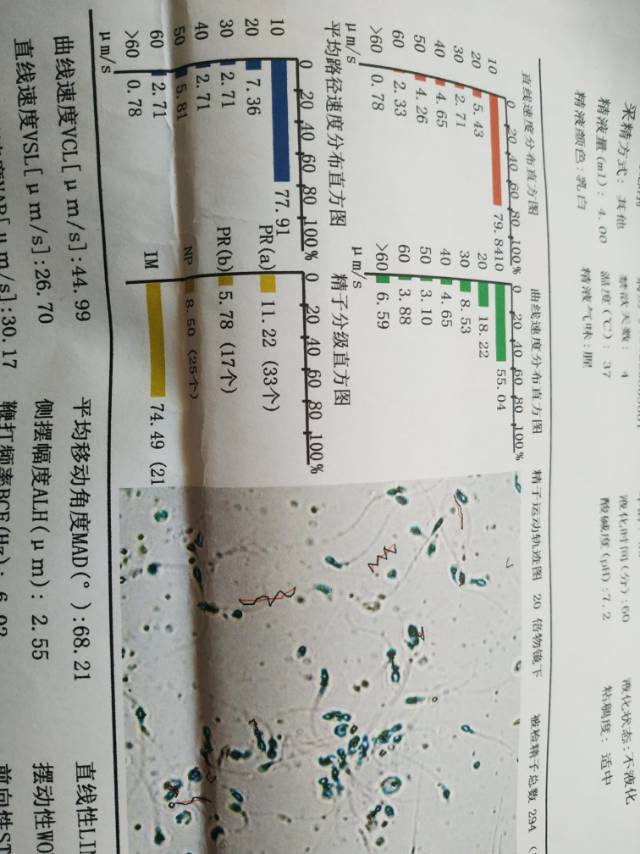 我多囊我老公精子不液化活力弱之前我做过促排卵