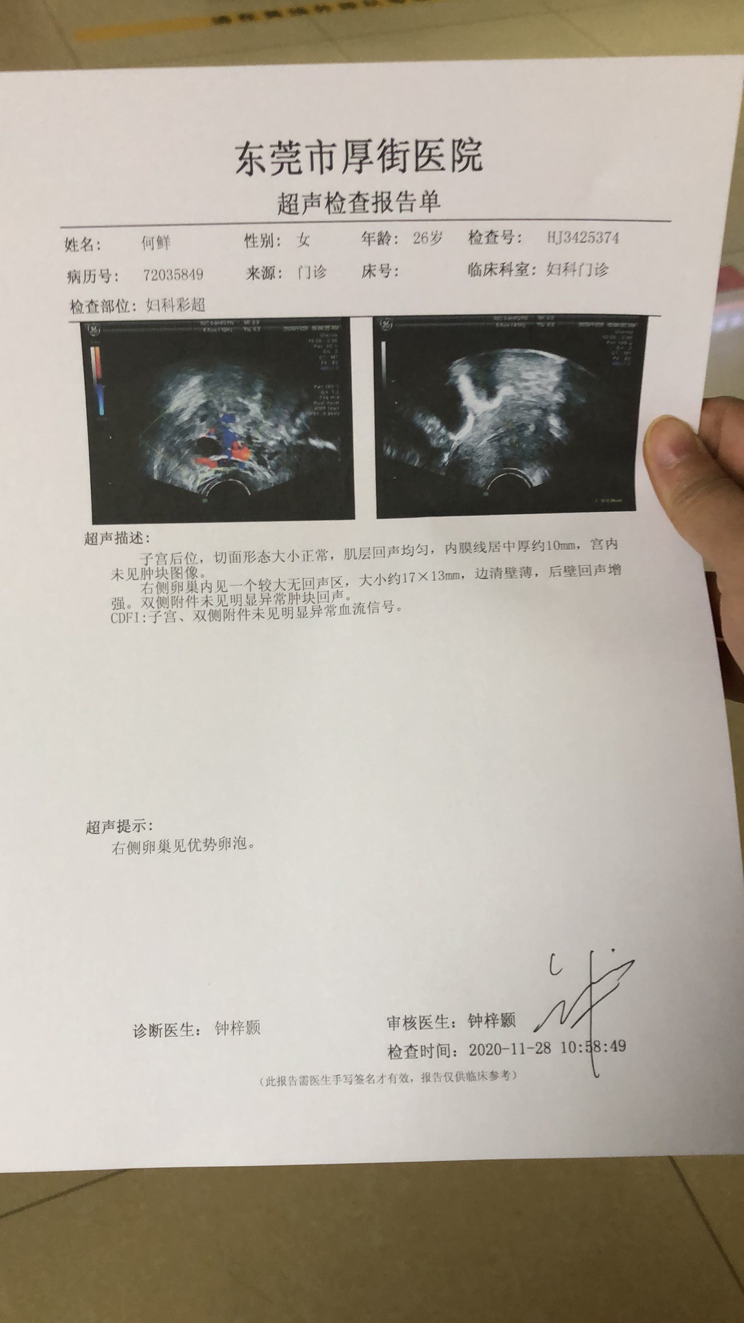 吃了促排来曲10颗内膜为什么长到10了排卵后