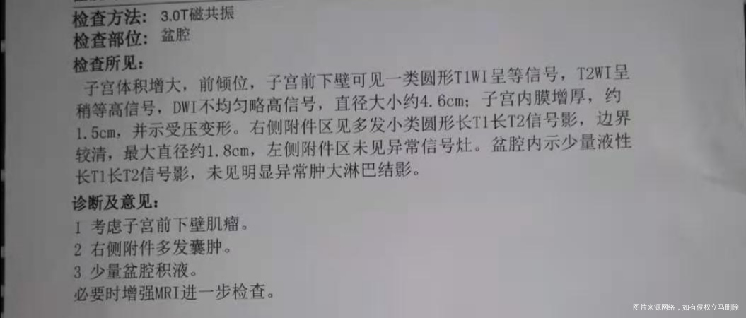 彩超医生说可能双子宫