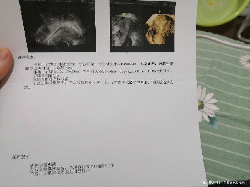 左卵巢旁见1310mm108mm无回声考虑输
