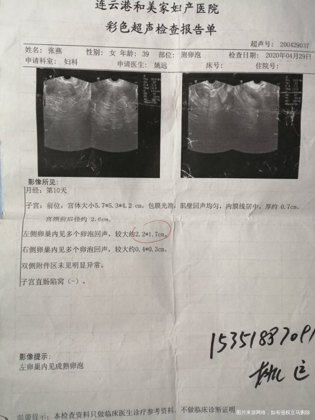 周期2628160斤疫情期间有节食减肥饮食不