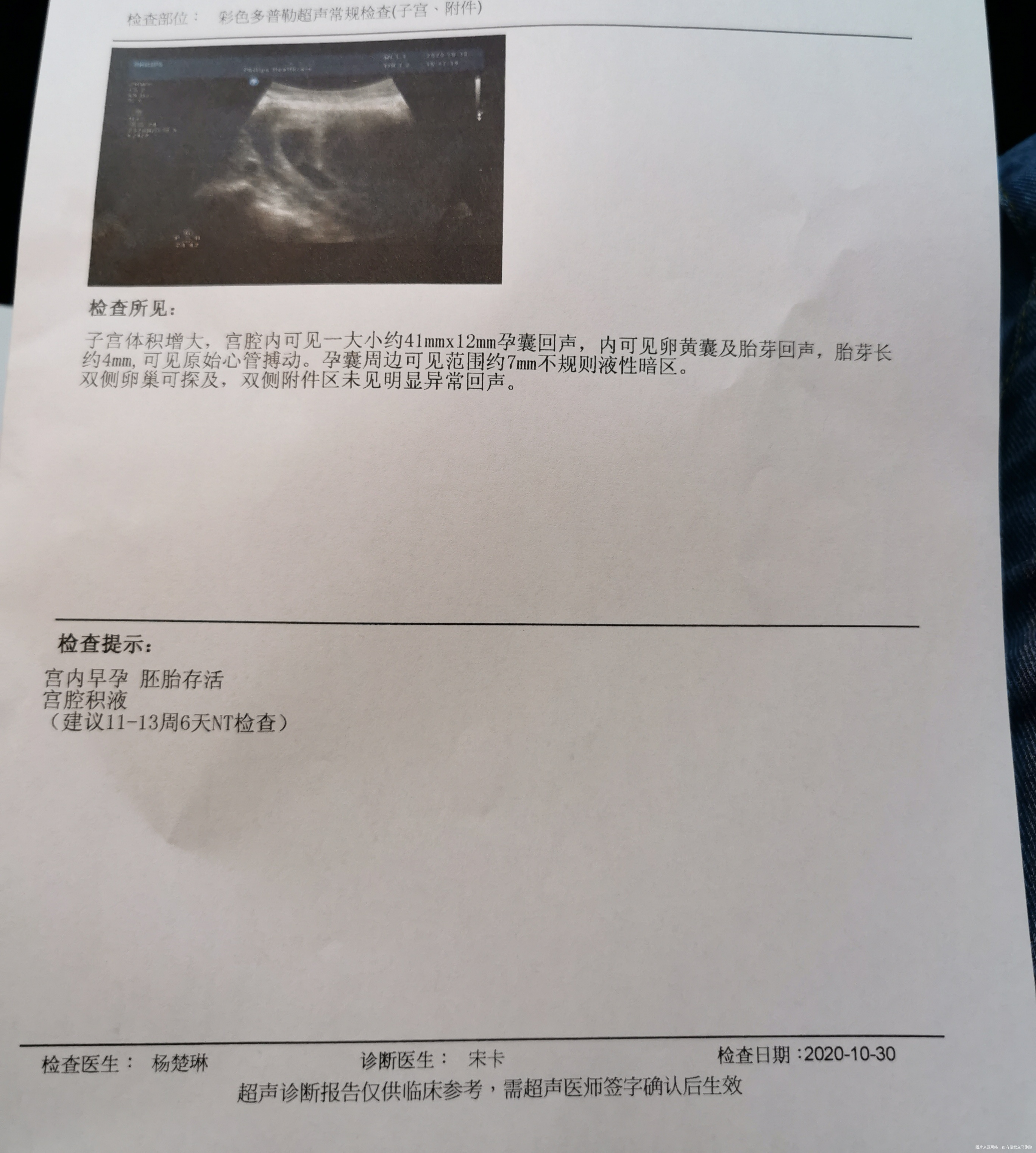 医生你好刚怀孕时四十多天第一次做b超查出有宫