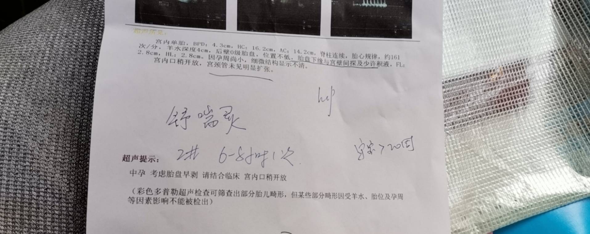 我吃安保怎么吃合适大约吃到什么时候