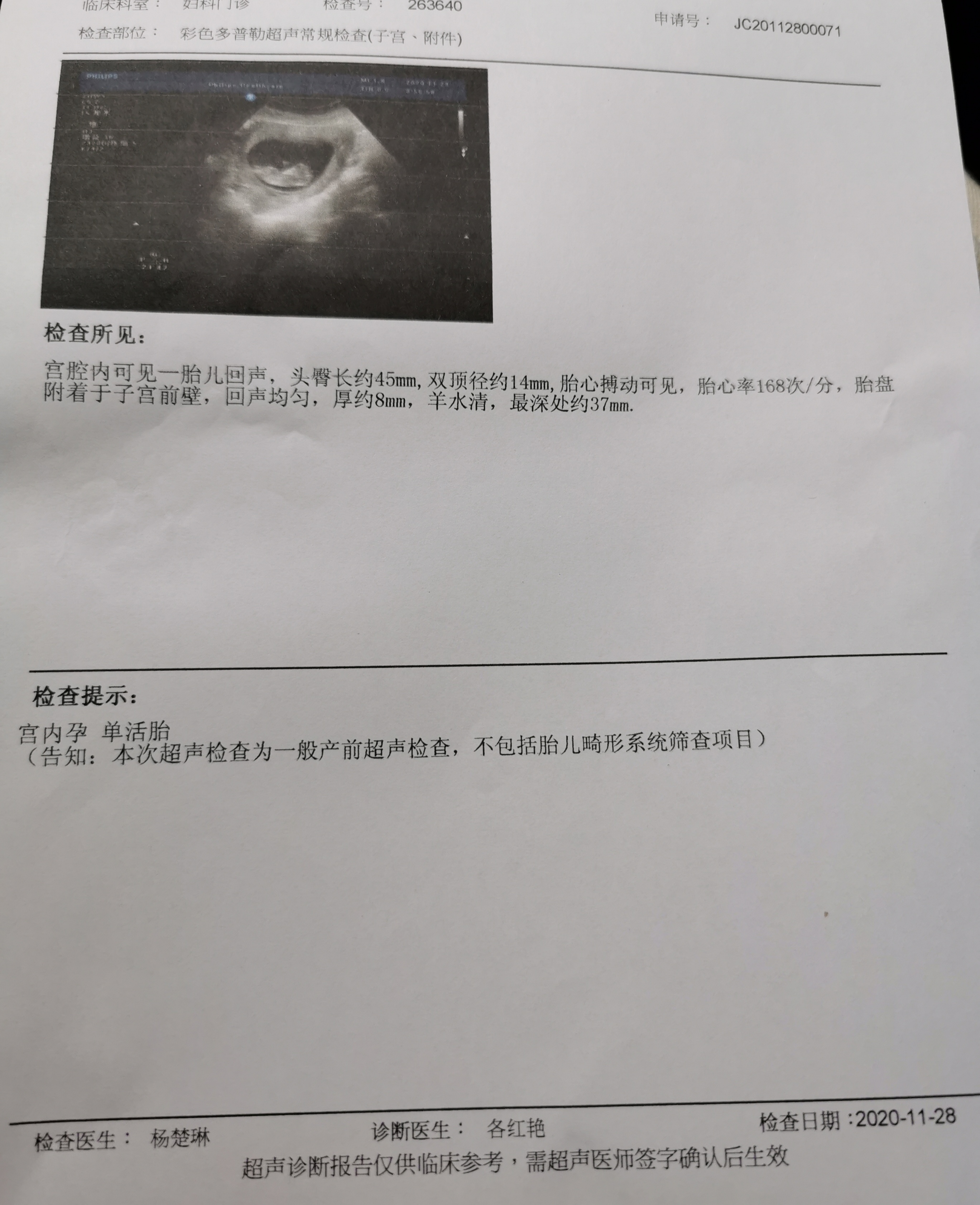 上周做b超有积液很担心这周又去做了b超发现一