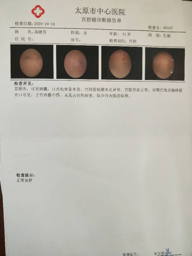 促排四周期备孕不成例假28天周期不提前不退后