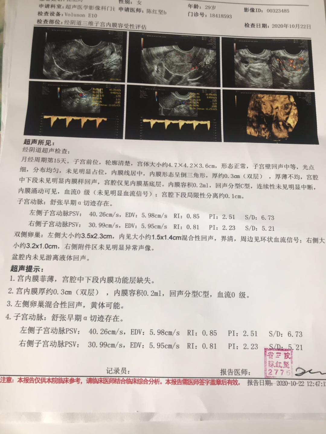 从没怀过患过内膜结核抗结核治疗一年半后面取了