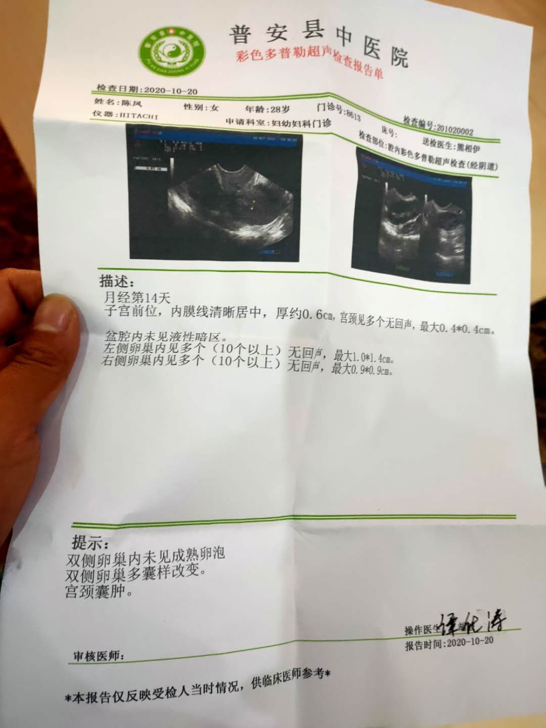 患多囊卵巢三年了现在想怀孕