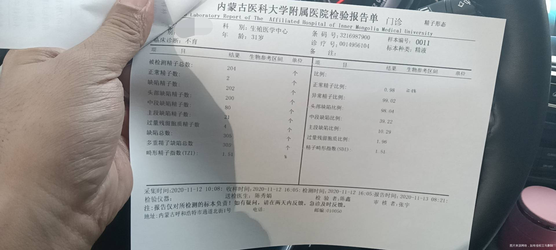 备孕快三年了一直不怀孕备孕一年没怀检查老公精