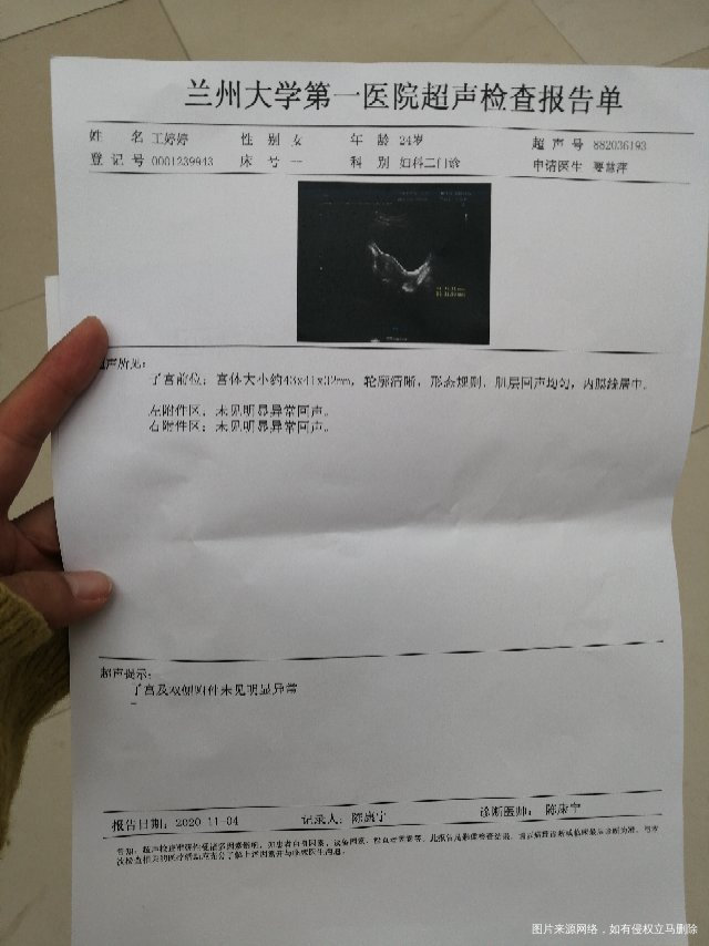 卵巢早衰月经第三天做的检查这个情况怎么样