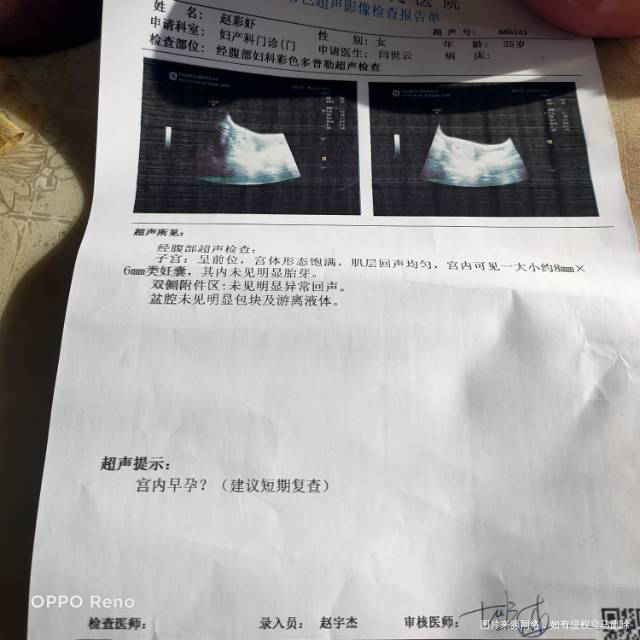 移植冻囊胚两个第17天做彩超检查宫内一个还有