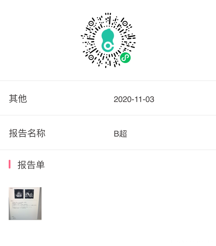 请问我这个排卵了吗10月31号打了10000