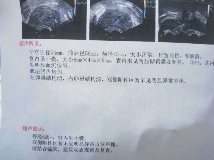 胚胎停止发育了要去医院做什么处理吗之前看的医