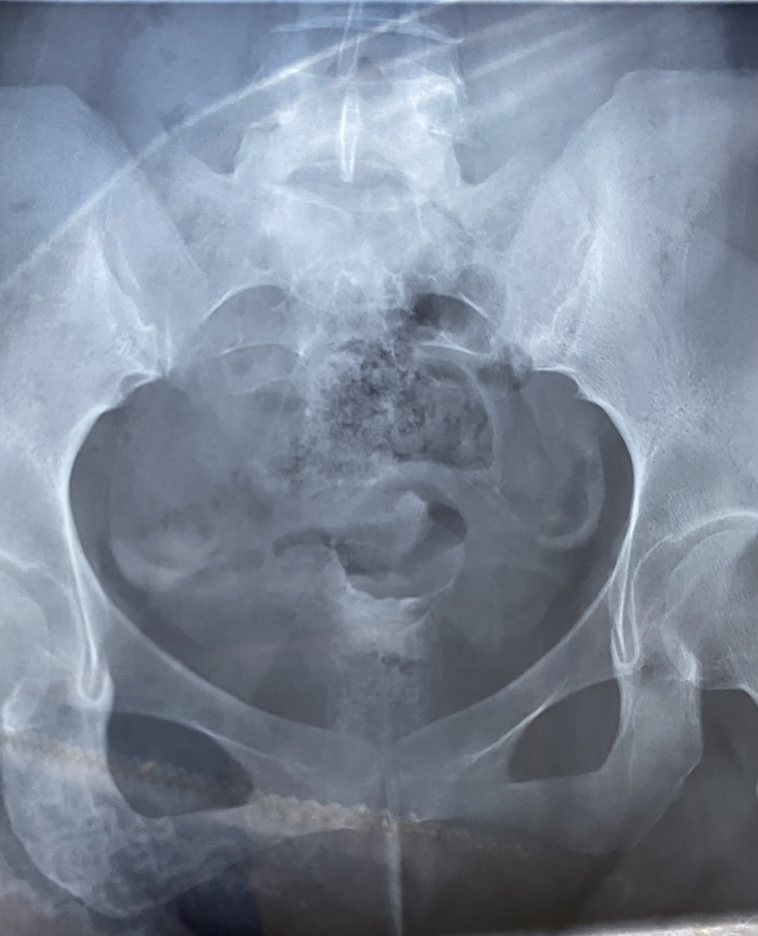 医生您好帮我看看输卵管报告报告上虽然没有异常