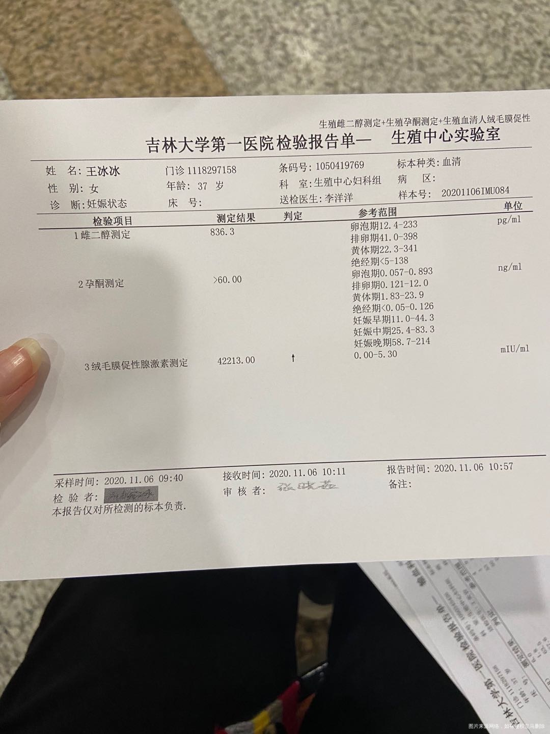 试管移植第25天无胎心胎芽