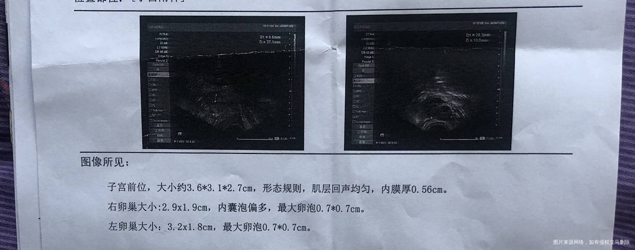 月经40天左右来一次量不多3~4天结束无流产