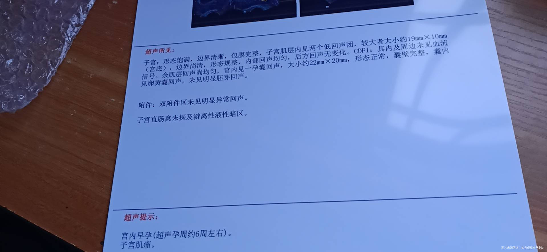 怀孕六周没胎胎心胎芽怎么办