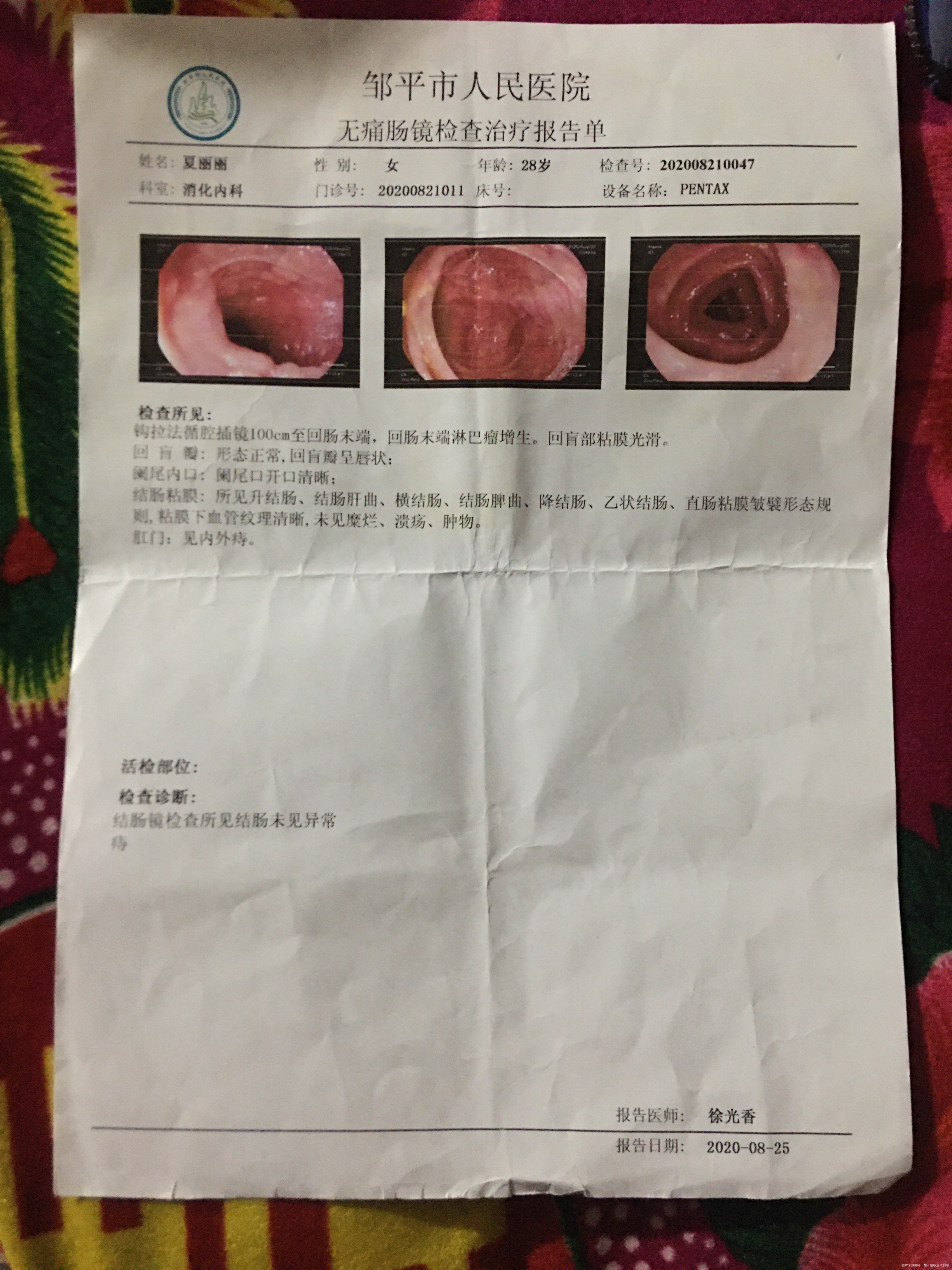 肚脐周围每天都疼痛不知道什么原因引起的但是做