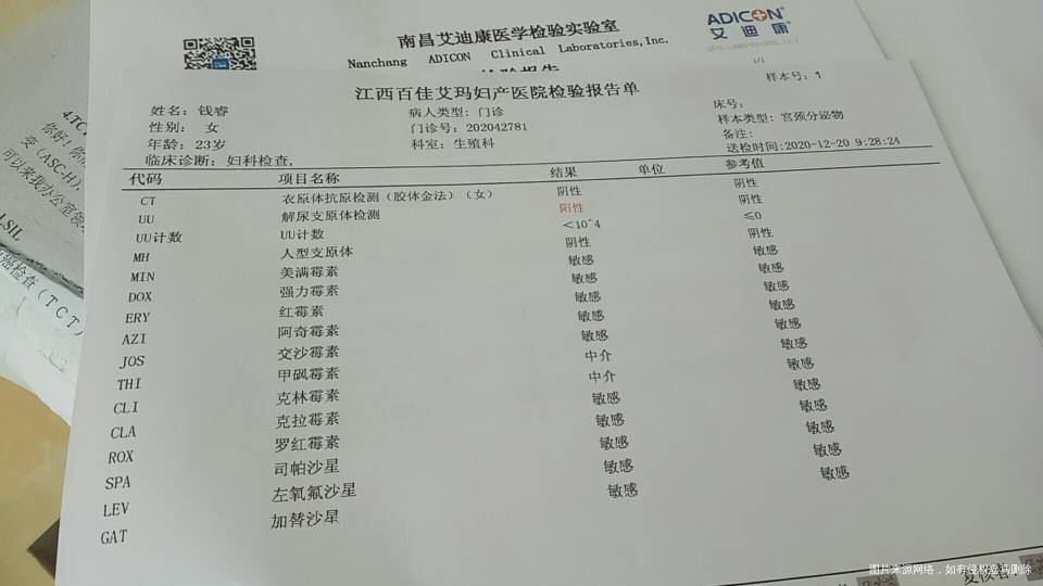 做了白带检测尿检和抽血B超显示有霉菌阴道炎吧