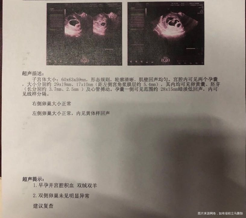 移植后第43天间断出血1周现在孕囊旁积血有什