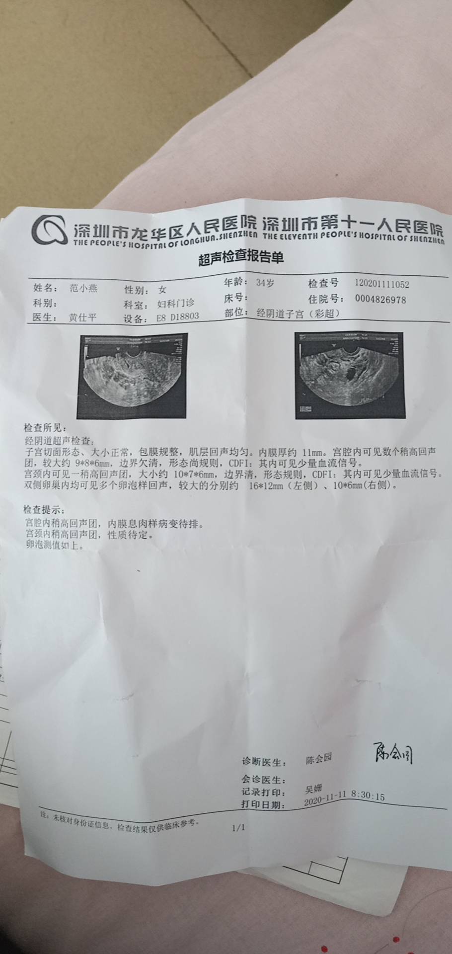 您好医生我是多囊我现在在备孕请问下检查报告中